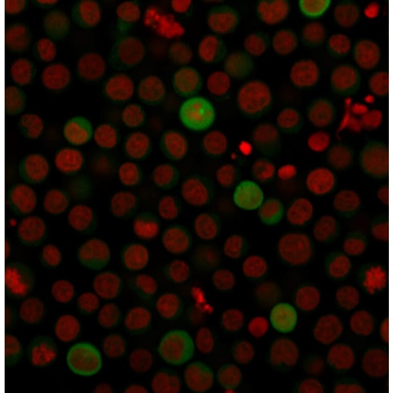 Immunofluorescence - Anti-PD-L1 Antibody [PDL1/2743] (CF®568) (A354081) - Antibodies.com