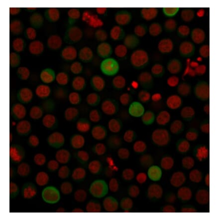 Immunofluorescence - Anti-PD-L1 Antibody [PDL1/2743] (CF®488A) (A354083) - Antibodies.com