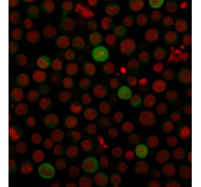 Immunofluorescence - Anti-PD-L1 Antibody [PDL1/2743] (CF®594) (A354084) - Antibodies.com