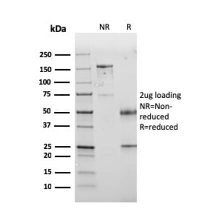 SDS-PAGE - Anti-PD-L1 Antibody [PDL1/2745] (CF®405S) (A354094) - Antibodies.com