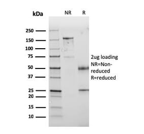 SDS-PAGE - Anti-PD-L1 Antibody [PDL1/2745] (CF®640R) (A354095) - Antibodies.com
