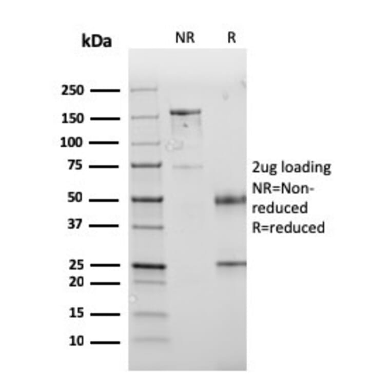 SDS-PAGE - Anti-PD-L1 Antibody [PDL1/2745] (CF®640R) (A354095) - Antibodies.com