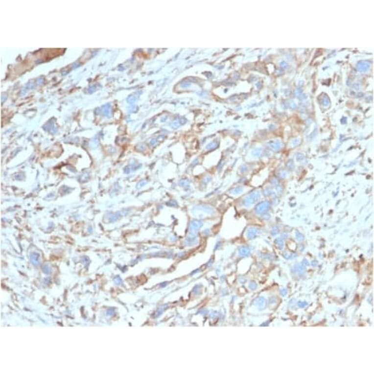 Immunohistochemistry (formalin-fixed, paraffin-embedded) - Anti-PD-L1 Antibody [PDL1/2746] (CF®640R) (A354103) - Antibodies.com