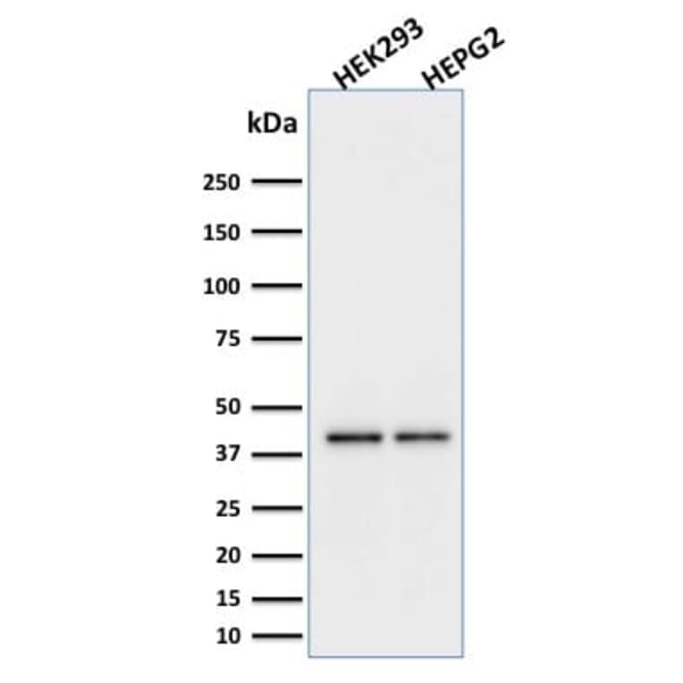 Wstern Blot - Anti-PD-L1 Antibody [PDL1/2746] (CF®640R) (A354103) - Antibodies.com