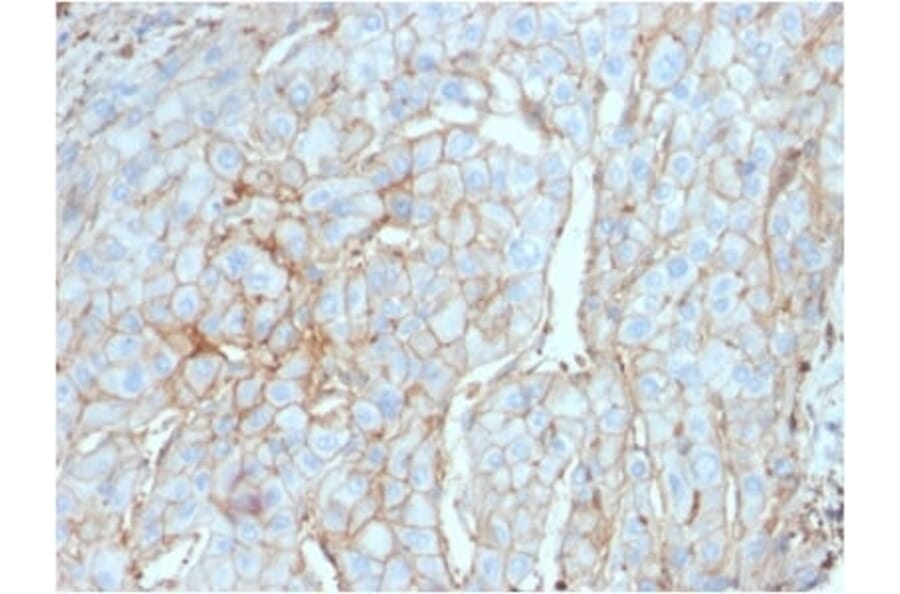 Immunohistochemistry (formalin-fixed, paraffin-embedded) - Anti-PD-L1 Antibody [PDL1/2746] (CF®543) (A354104) - Antibodies.com