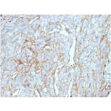 Immunohistochemistry (formalin-fixed, paraffin-embedded) - Anti-PD-L1 Antibody [PDL1/2746] (CF®647) (A354105) - Antibodies.com