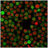Immunofluorescence - Anti-PD-L1 Antibody [PDL1/2746] (CF®568) (A354106) - Antibodies.com