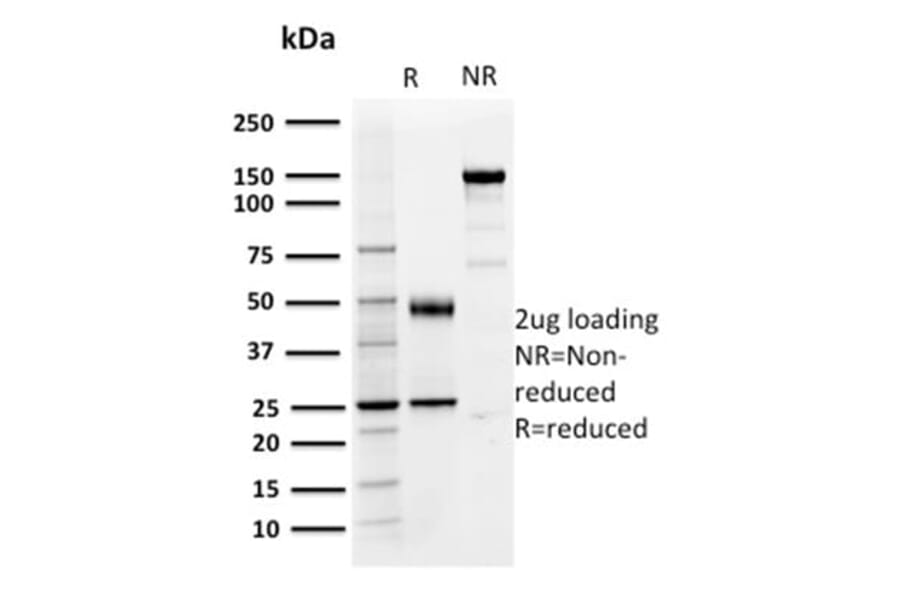 SDS-PAGE - Anti-PD-L1 Antibody [PDL1/2746] (CF®568) (A354106) - Antibodies.com