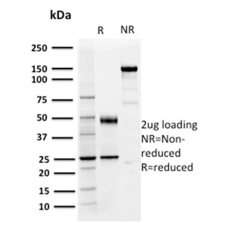 SDS-PAGE - Anti-PD-L1 Antibody [PDL1/2746] (CF®568) (A354106) - Antibodies.com