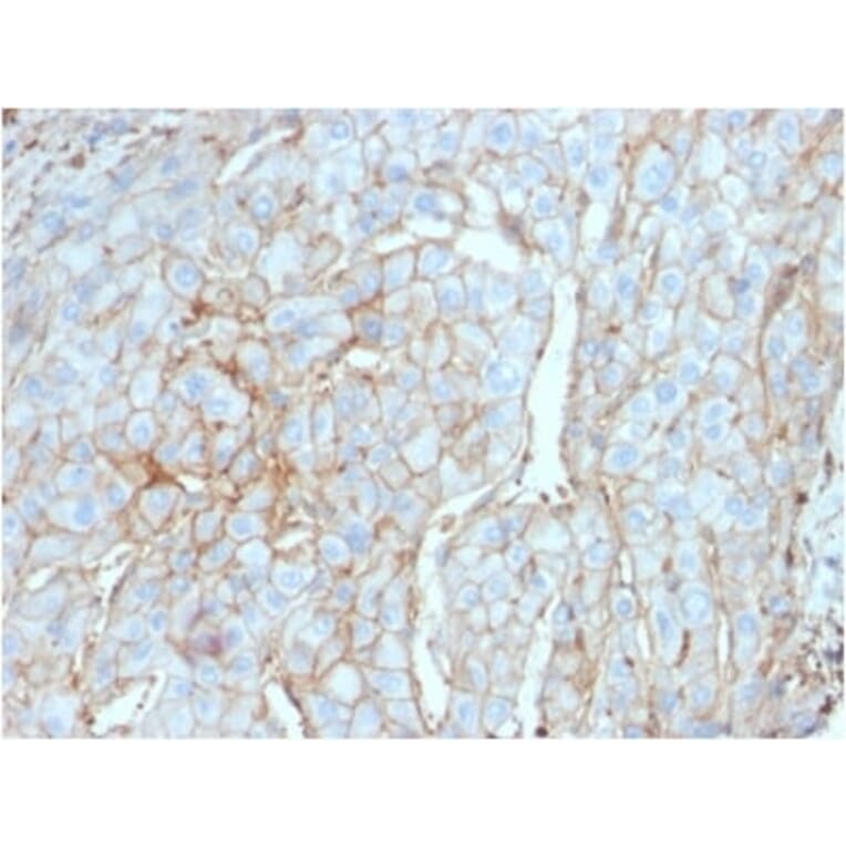 Immunohistochemistry (formalin-fixed, paraffin-embedded) - Anti-PD-L1 Antibody [PDL1/2746] (CF®568) (A354106) - Antibodies.com