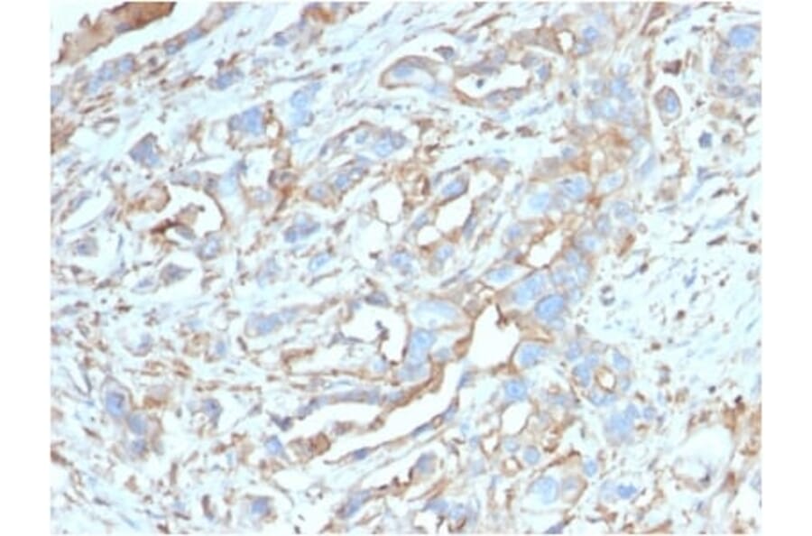 Immunohistochemistry (formalin-fixed, paraffin-embedded) - Anti-PD-L1 Antibody [PDL1/2746] (CF®568) (A354106) - Antibodies.com