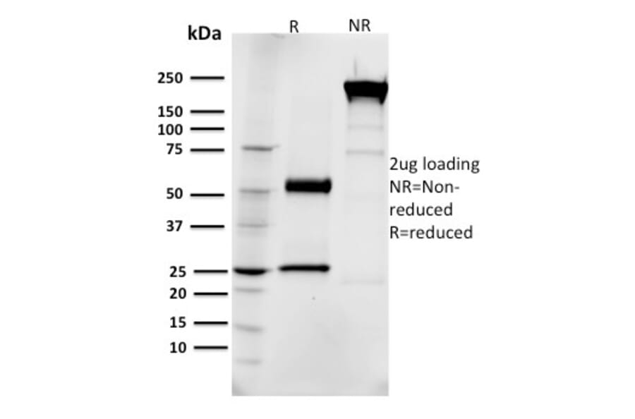 SDS-PAGE - Anti-EGFR Antibody [R1] (CF®640R) (A354112) - Antibodies.com