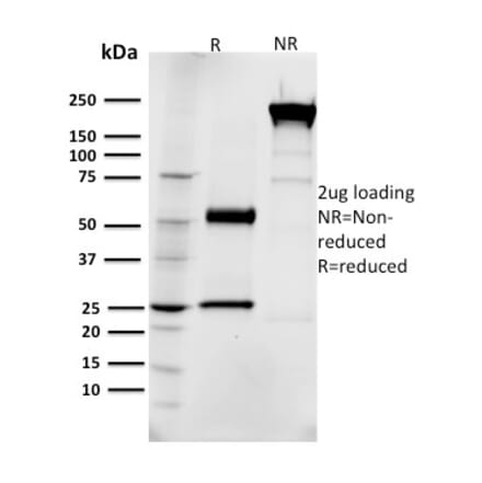 SDS-PAGE - Anti-EGFR Antibody [R1] (CF®640R) (A354112) - Antibodies.com