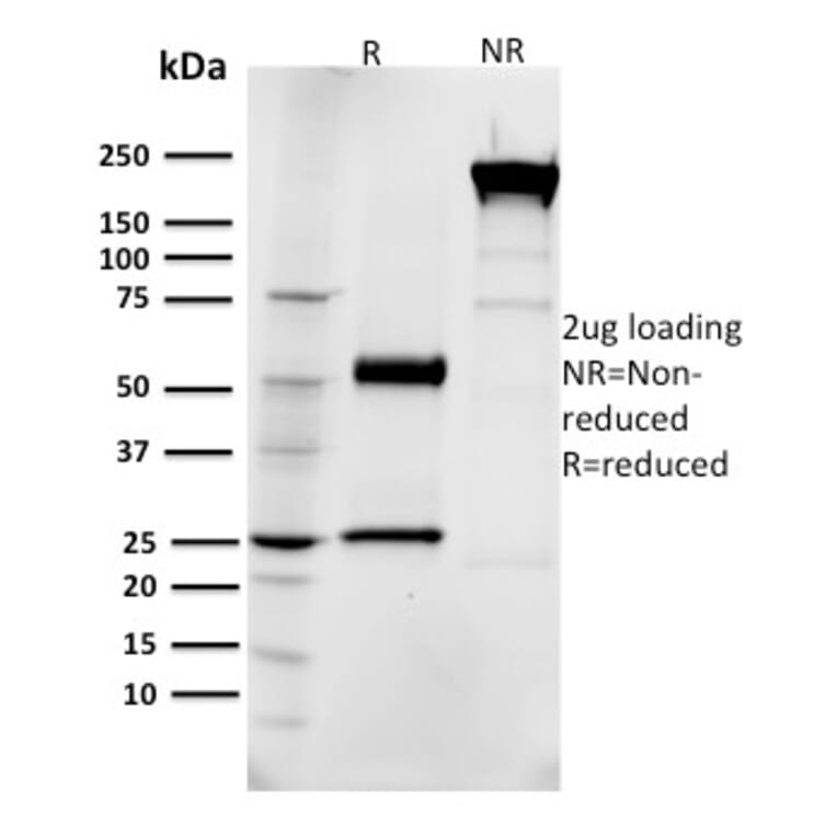 SDS-PAGE - Anti-EGFR Antibody [R1] (CF®640R) (A354112) - Antibodies.com
