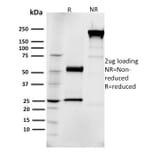 SDS-PAGE - Anti-EGFR Antibody [R1] (CF®647) (A354113) - Antibodies.com