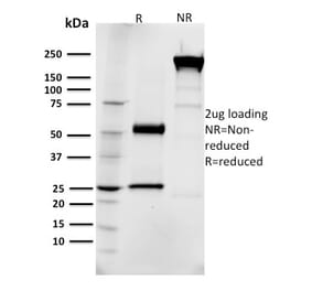 SDS-PAGE - Anti-EGFR Antibody [R1] (CF®594) (A354117) - Antibodies.com