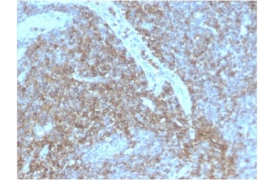 Immunohistochemistry (formalin-fixed, paraffin-embedded) - Anti-CD44 Antibody [HCAM/2875R] (CF®647) (A354129) - Antibodies.com