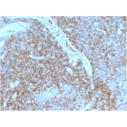 Immunohistochemistry (formalin-fixed, paraffin-embedded) - Anti-CD44 Antibody [HCAM/2875R] (CF®740) (A354131) - Antibodies.com