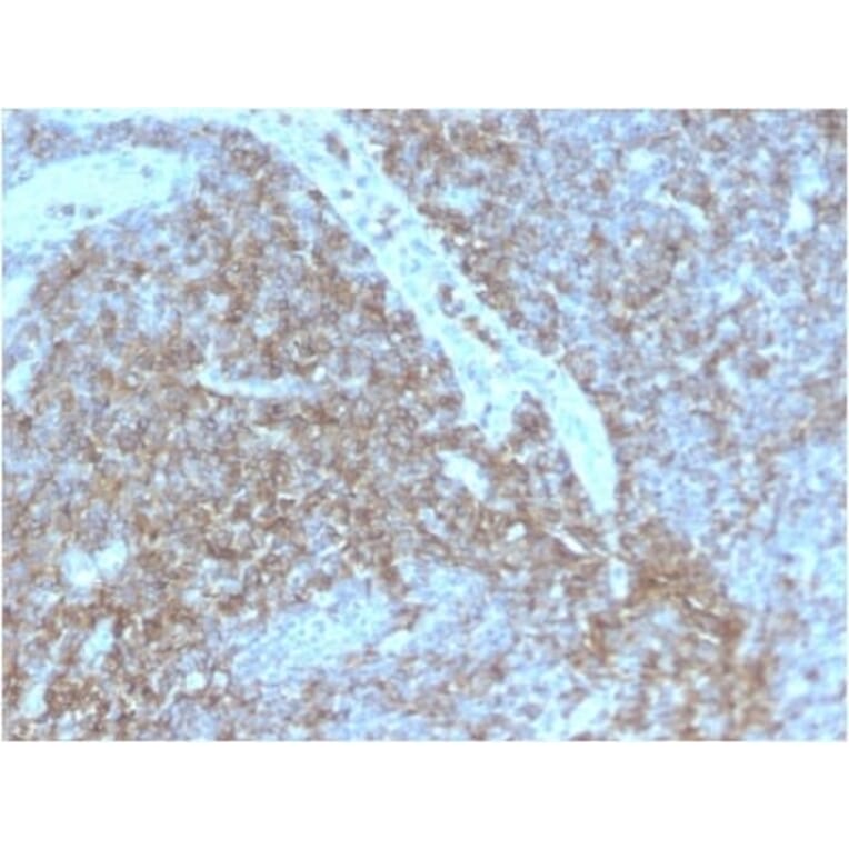 Immunohistochemistry (formalin-fixed, paraffin-embedded) - Anti-CD44 Antibody [HCAM/2875R] (CF®488A) (A354132) - Antibodies.com