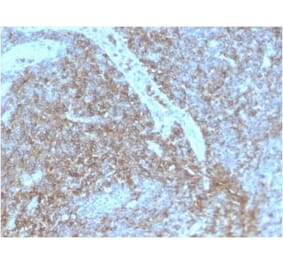 Immunohistochemistry (formalin-fixed, paraffin-embedded) - Anti-CD44 Antibody [HCAM/2875R] (CF®594) (A354133) - Antibodies.com