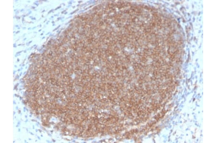 Immunohistochemistry (formalin-fixed, paraffin-embedded) - Anti-CD45RB Antibody [PTPRC/2877R] (CF®405S) (A354135) - Antibodies.com
