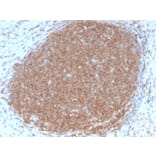 Immunohistochemistry (formalin-fixed, paraffin-embedded) - Anti-CD45RB Antibody [PTPRC/2877R] (CF®640R) (A354136) - Antibodies.com