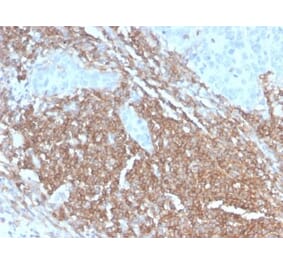 Immunohistochemistry (formalin-fixed, paraffin-embedded) - Anti-CD45RB Antibody [PTPRC/2877R] (CF®647) (A354137) - Antibodies.com