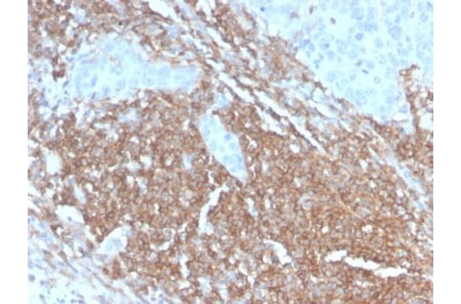 Immunohistochemistry (formalin-fixed, paraffin-embedded) - Anti-CD45RB Antibody [PTPRC/2877R] (CF®647) (A354137) - Antibodies.com