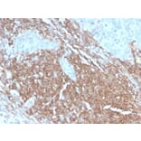 Immunohistochemistry (formalin-fixed, paraffin-embedded) - Anti-CD45RB Antibody [PTPRC/2877R] (CF®647) (A354137) - Antibodies.com