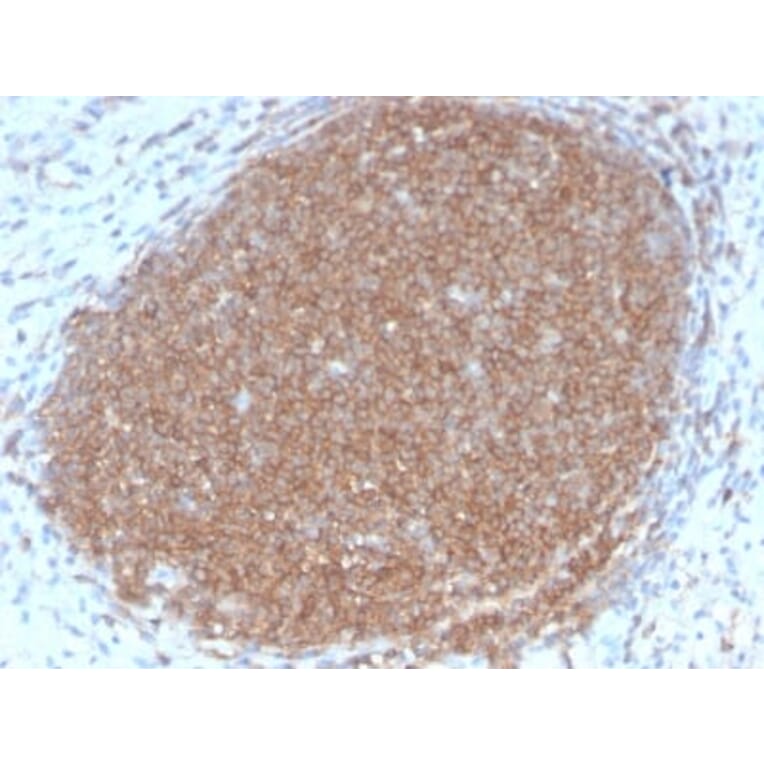 Immunohistochemistry (formalin-fixed, paraffin-embedded) - Anti-CD45RB Antibody [PTPRC/2877R] (CF®594) (A354141) - Antibodies.com