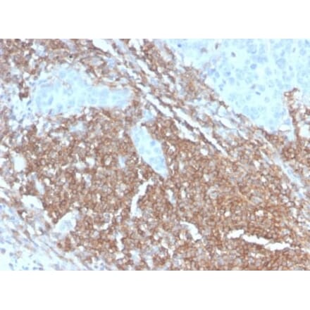 Immunohistochemistry (formalin-fixed, paraffin-embedded) - Anti-CD45RB Antibody [PTPRC/2877R] (Biotin) (A354142) - Antibodies.com