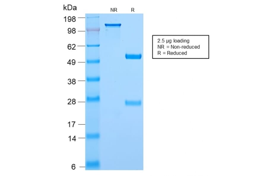 SDS-PAGE - Anti-c-Myc Antibody [MYC2895R] (CF®568) (A354146) - Antibodies.com