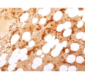 Immunohistochemistry (formalin-fixed, paraffin-embedded) - Anti-Transferrin Receptor Antibody [TFRC/2898R] (CF®647) (A354153) - Antibodies.com