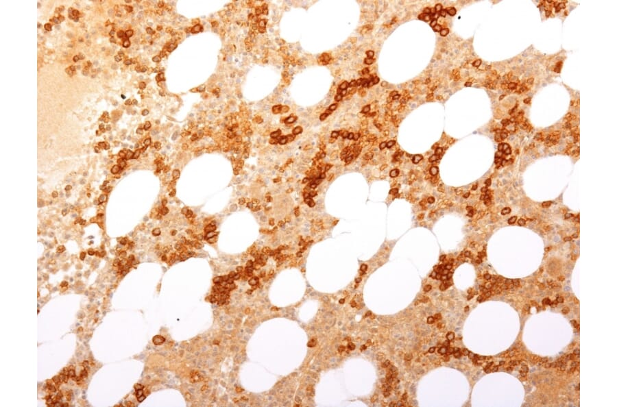 Immunohistochemistry (formalin-fixed, paraffin-embedded) - Anti-Transferrin Receptor Antibody [TFRC/2898R] (Biotin) (A354158) - Antibodies.com