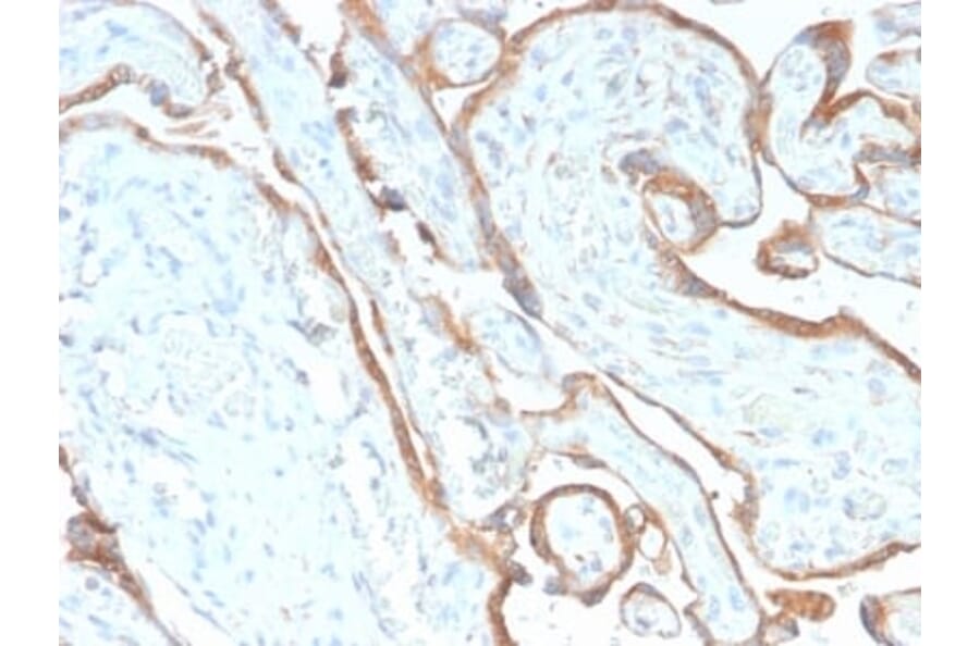 Immunohistochemistry (formalin-fixed, paraffin-embedded) - Anti-EGFR Antibody [GFR/2968R] (CF®647) (A354161) - Antibodies.com
