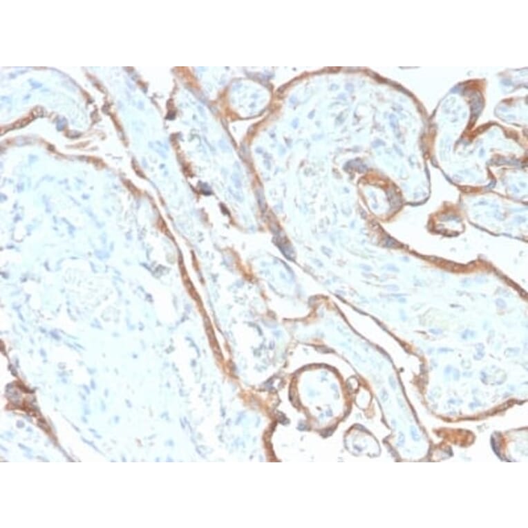 Immunohistochemistry (formalin-fixed, paraffin-embedded) - Anti-EGFR Antibody [GFR/2968R] (CF®647) (A354161) - Antibodies.com