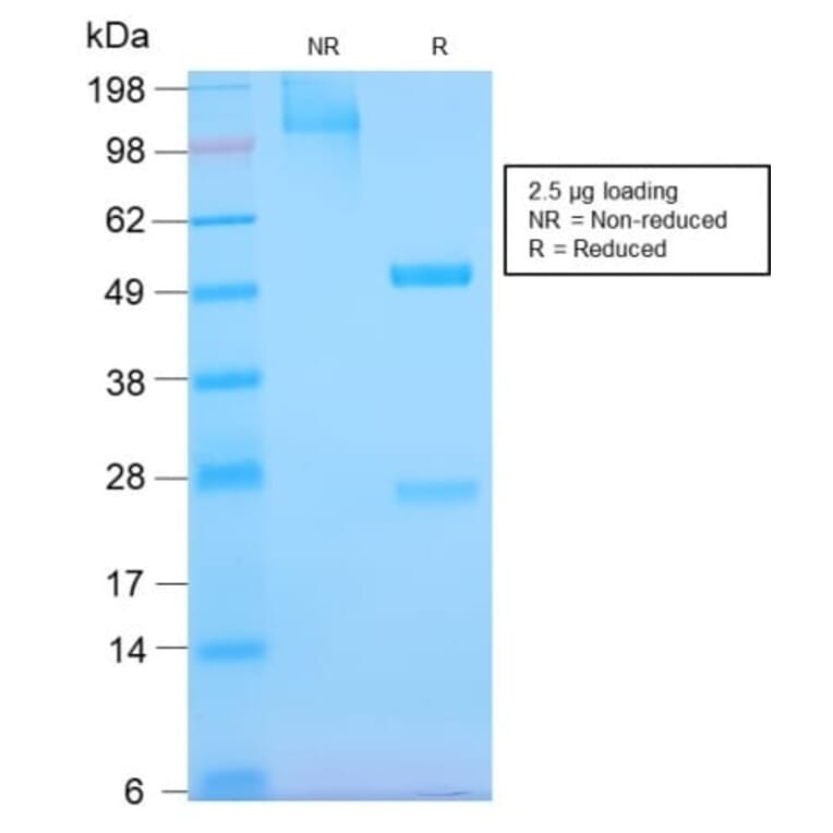 SDS-PAGE - Anti-EGFR Antibody [GFR/2968R] (CF®647) (A354161) - Antibodies.com