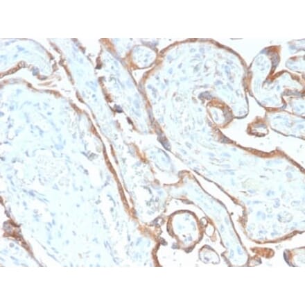 Immunohistochemistry (formalin-fixed, paraffin-embedded) - Anti-EGFR Antibody [GFR/2968R] (CF®568) (A354162) - Antibodies.com
