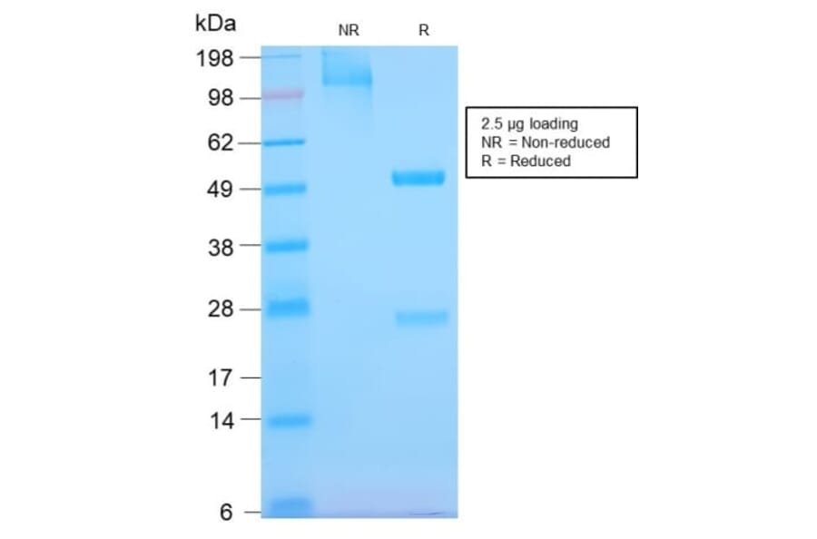 SDS-PAGE - Anti-EGFR Antibody [GFR/2968R] (CF®740) (A354163) - Antibodies.com
