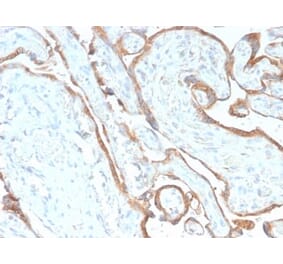 Immunohistochemistry (formalin-fixed, paraffin-embedded) - Anti-EGFR Antibody [GFR/2968R] (CF®488A) (A354164) - Antibodies.com