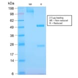 SDS-PAGE - Anti-EGFR Antibody [GFR/2968R] (CF®594) (A354165) - Antibodies.com