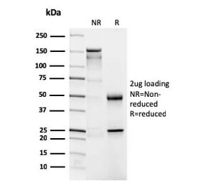 SDS-PAGE - Anti-CD4 Antibody [CD4/3026] (CF®740) (A354171) - Antibodies.com
