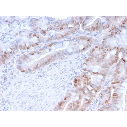 Immunohistochemistry (formalin-fixed, paraffin-embedded) - Anti-PCNA Antibody [PC5] (CF®640R) (A354184) - Antibodies.com