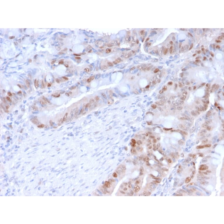 Immunohistochemistry (formalin-fixed, paraffin-embedded) - Anti-PCNA Antibody [PC5] (CF®647) (A354185) - Antibodies.com