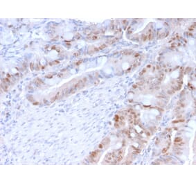 Immunohistochemistry (formalin-fixed, paraffin-embedded) - Anti-PCNA Antibody [PC5] (CF®740) (A354187) - Antibodies.com
