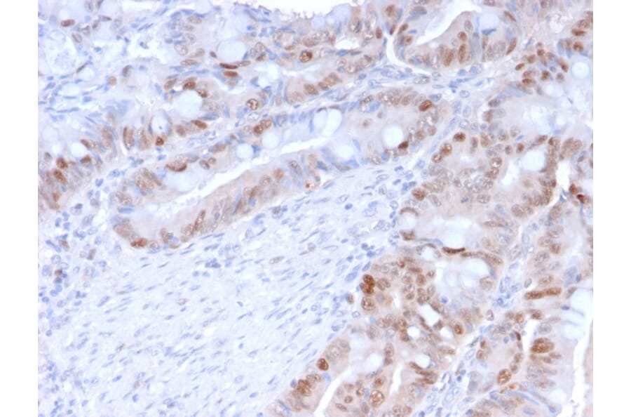 Immunohistochemistry (formalin-fixed, paraffin-embedded) - Anti-PCNA Antibody [PC5] (Biotin) (A354190) - Antibodies.com