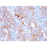 Immunohistochemistry (formalin-fixed, paraffin-embedded) - Anti-ErbB2 Antibody [ERBB2/3080] (CF®488A) (A354220) - Antibodies.com