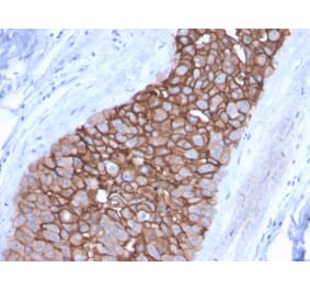 Immunohistochemistry (formalin-fixed, paraffin-embedded) - Anti-ErbB2 Antibody [ERBB2/3092] (CF®488A) (A354228) - Antibodies.com
