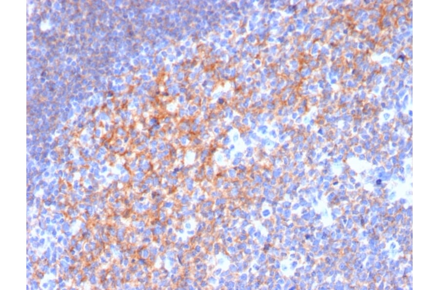 Immunohistochemistry (formalin-fixed, paraffin-embedded) - Anti-CD19 Antibody [CD19/3116] (CF®647) (A354241) - Antibodies.com