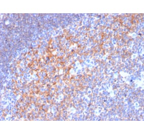 Immunohistochemistry (formalin-fixed, paraffin-embedded) - Anti-CD19 Antibody [CD19/3116] (CF®568) (A354242) - Antibodies.com